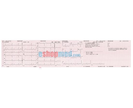 Suzuken Kenz Cardico 601, Ηλεκτροκαρδιογράφος 3/6 Καναλιών - Ηλεκτροκαρδιογράφοι στο eShopmed