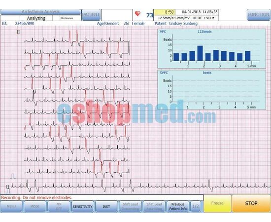 Suzuken Kenz Cardico PC-1201, Ηλεκτροκαρδιογράφος 12 Καναλιών Βασιζόμενος σε Η/Υ ΕΚΘΕΣΙΑΚΟ - Ηλεκτροκαρδιογράφοι στο eShopmed