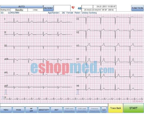 Suzuken Kenz Cardico PC-1201, Ηλεκτροκαρδιογράφος 12 Καναλιών Βασιζόμενος σε Η/Υ ΕΚΘΕΣΙΑΚΟ - Ηλεκτροκαρδιογράφοι στο eShopmed