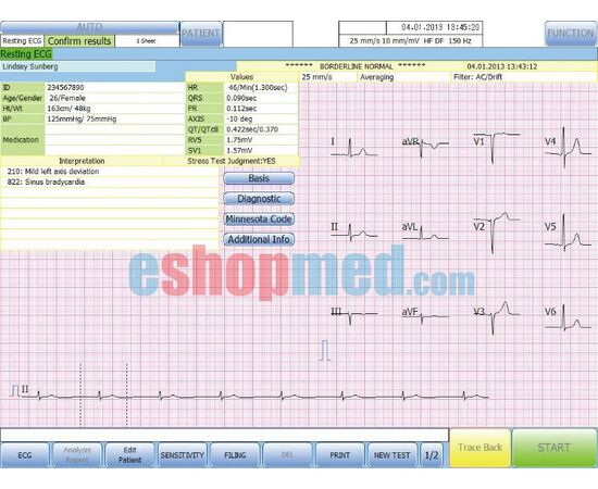 Suzuken Kenz Cardico PC-1201, Ηλεκτροκαρδιογράφος 12 Καναλιών Βασιζόμενος σε Η/Υ ΕΚΘΕΣΙΑΚΟ - Ηλεκτροκαρδιογράφοι στο eShopmed