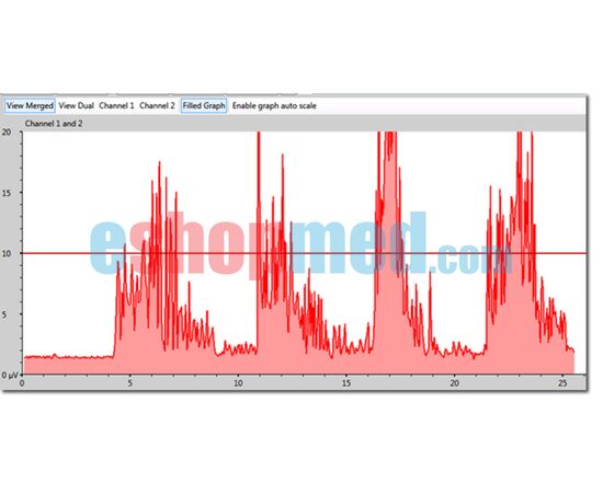 MyoPlus2 Pro Bluetooth - 2 Καναλιών Συσκευή Βιολογικής Επανατροφοδότησης (biofeedback) και Ηλεκτροδιέγερσης, με Έγχρωμη Οθόνη Αφής και Λογισμικό Η/Υ με Ασύρματη Σύνδεση - Βιολογική Επανατροφοδότηση στο eShopmed