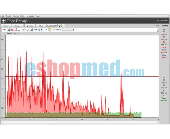 MyoPlus2 Pro Bluetooth - 2 Καναλιών Συσκευή Βιολογικής Επανατροφοδότησης (biofeedback) και Ηλεκτροδιέγερσης, με Έγχρωμη Οθόνη Αφής και Λογισμικό Η/Υ με Ασύρματη Σύνδεση - Βιολογική Επανατροφοδότηση στο eShopmed