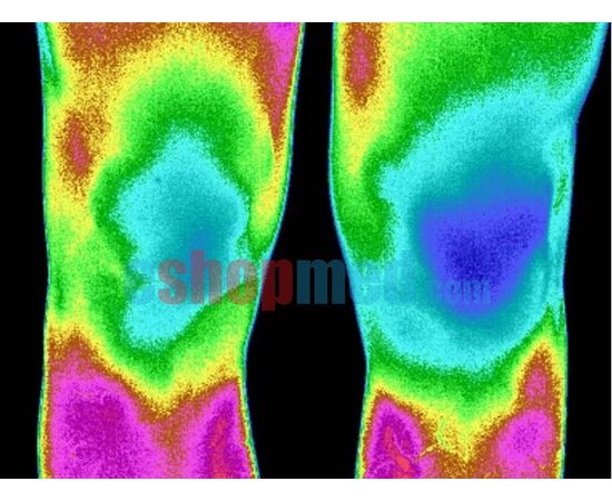 GIGAA FIRELAS 26.2W Laser διόδου με 4 Μήκη Κύματος 810nm/8W + 980nm/10W + 1064nm/8W + 635nm/0,2W - Laser στο eShopmed