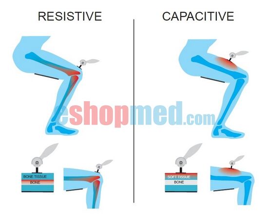PHYSIOLED THERMA Συσκευή Θεραπείας Tecar - Tecar στο eShopmed